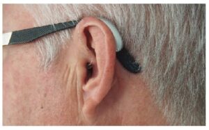 Guide om høreapparater